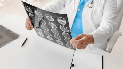 Seeing Beyond the Scans: TBI Illustration Tech