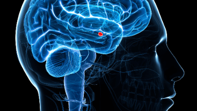 Amygdala Hijack: Using Neuroscience to Save Your Witness